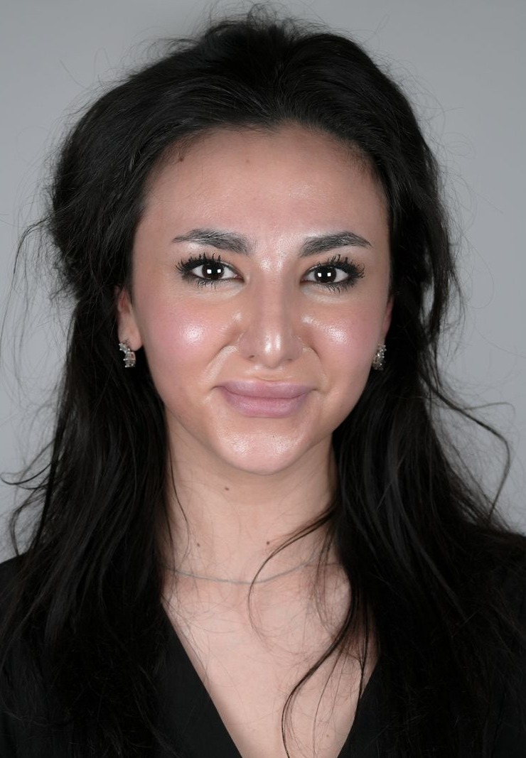 Benmestoura Elza